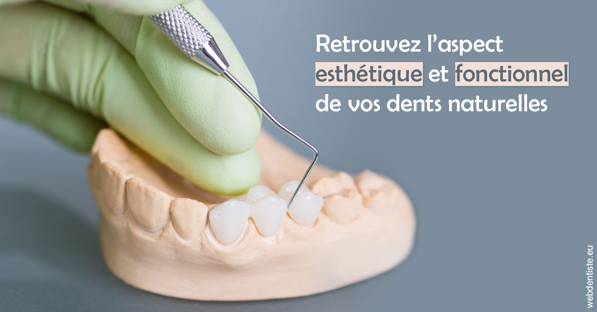 https://dr-alain-huet.chirurgiens-dentistes.fr/Restaurations dentaires 1