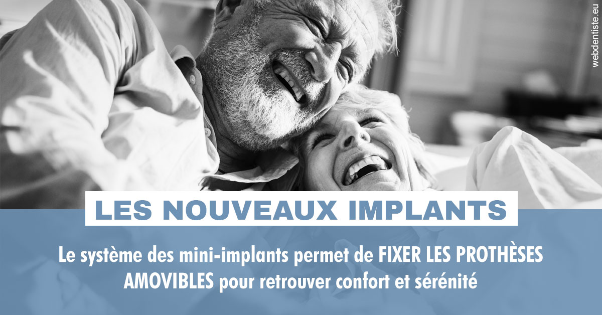 https://dr-alain-huet.chirurgiens-dentistes.fr/Les nouveaux implants 2