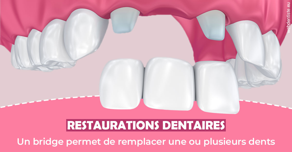 https://dr-alain-huet.chirurgiens-dentistes.fr/Bridge remplacer dents 2