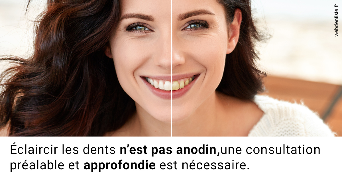 https://dr-alain-huet.chirurgiens-dentistes.fr/Le blanchiment 2