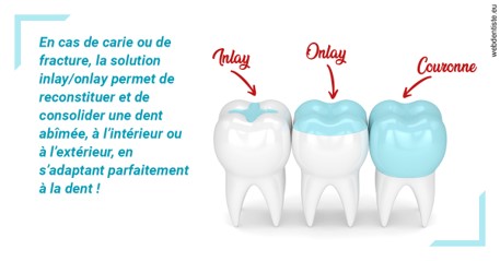 https://dr-alain-huet.chirurgiens-dentistes.fr/L'INLAY ou l'ONLAY