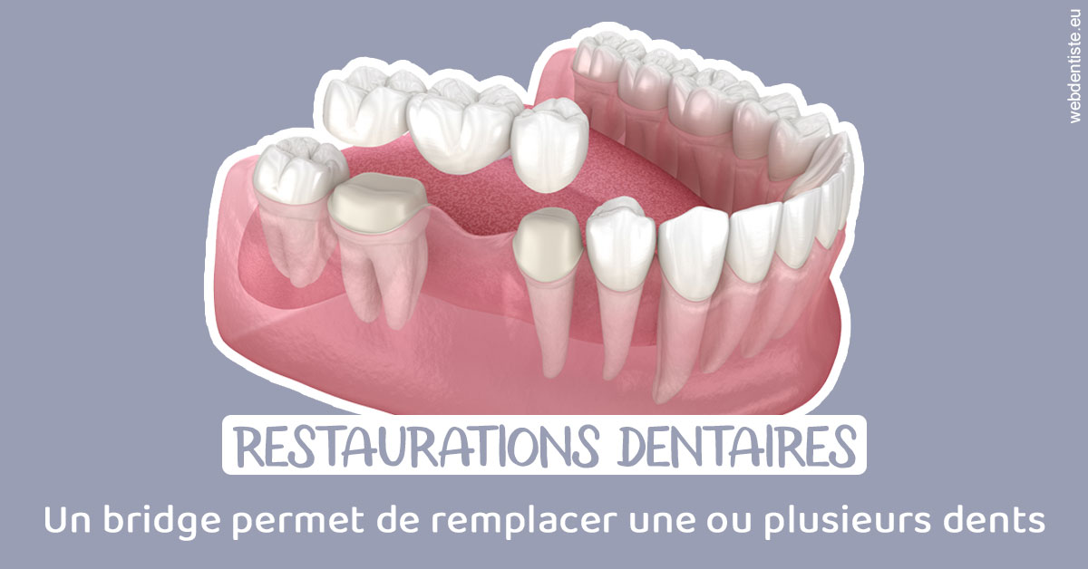 https://dr-alain-huet.chirurgiens-dentistes.fr/Bridge remplacer dents 1