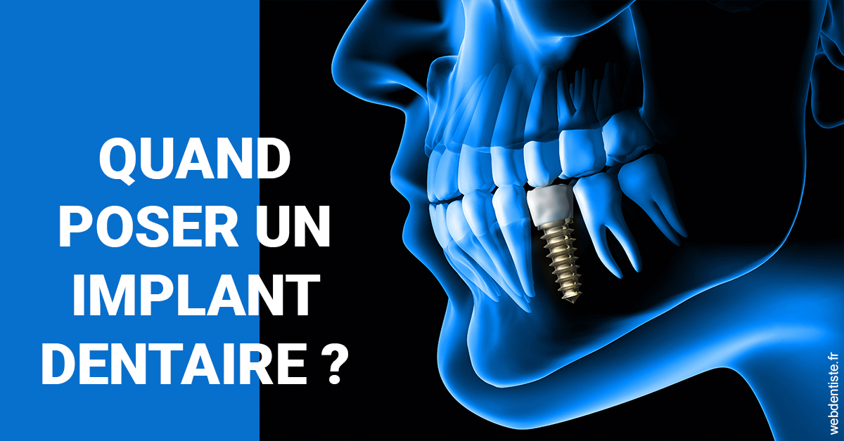 https://dr-alain-huet.chirurgiens-dentistes.fr/Les implants 1