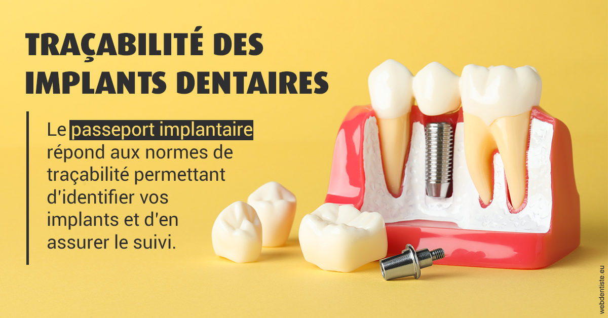 https://dr-alain-huet.chirurgiens-dentistes.fr/T2 2023 - Traçabilité des implants 2