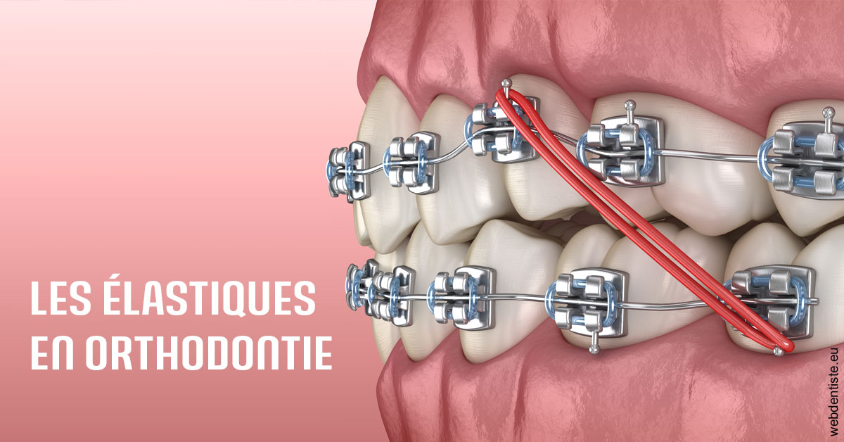 https://dr-alain-huet.chirurgiens-dentistes.fr/Elastiques orthodontie 2