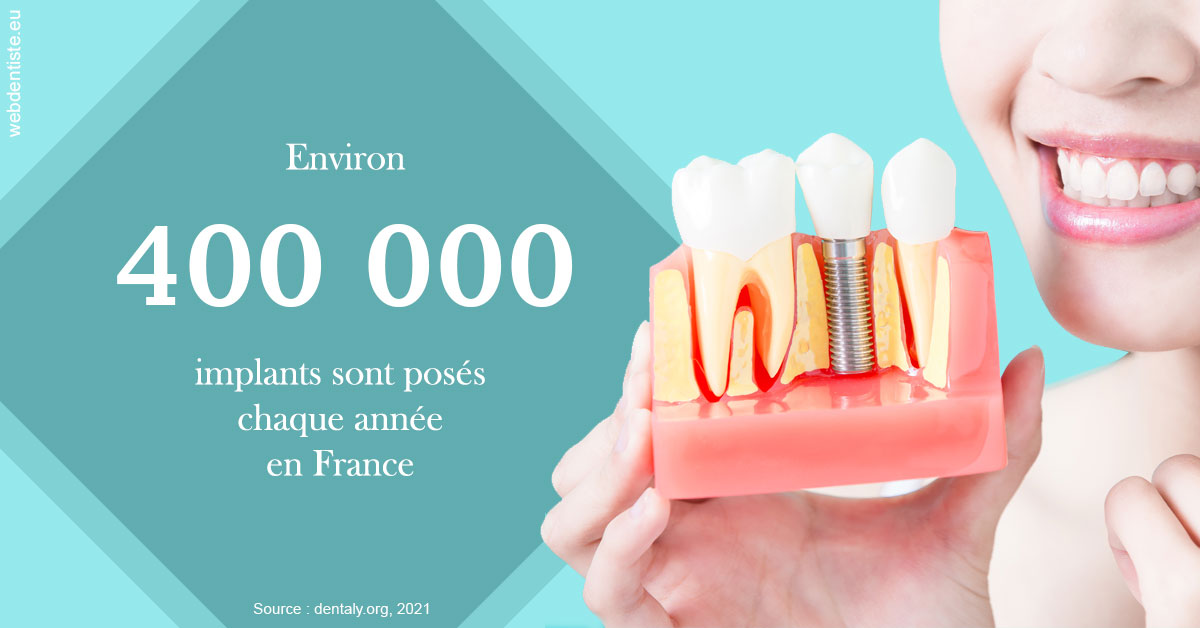 https://dr-alain-huet.chirurgiens-dentistes.fr/Pose d'implants en France 2